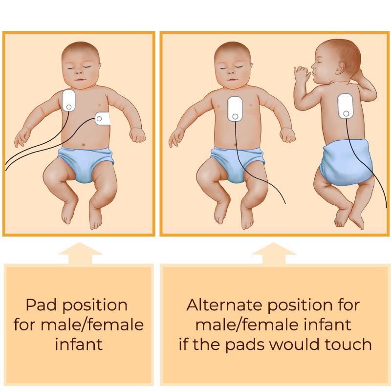 Pediatric CPR OSCE Update 2026